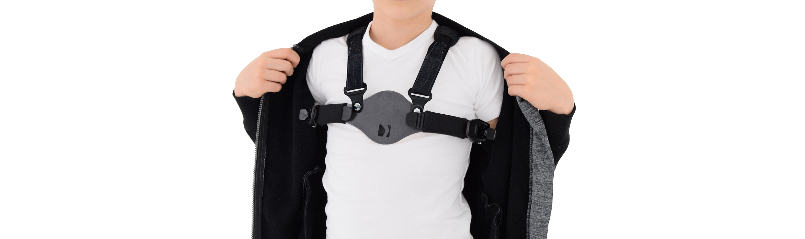 Custom Brace for Pectus Carinatum, also known as Pigeon Chest