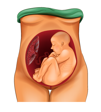 Breech womb position